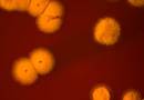 Gizakiak infektatzen dituen bakterio espezie berria: Nocardia donostiensis