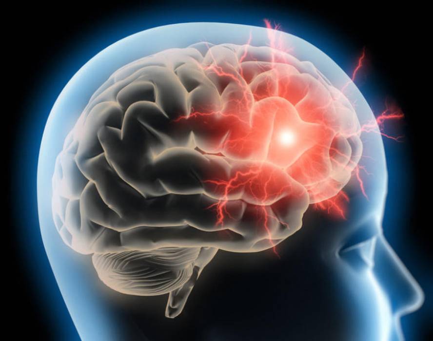 migrainak-zein-mekanismoren-bidez-sortzen-diren-id