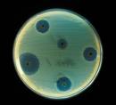 Bakterio erresistenteei aurre egiteko plana aurkeztu du Europako Batasunak 